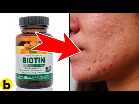 Biotin Side Effects: Is It Safe for You? post thumbnail image