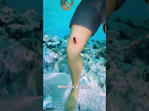 Recognizing Stingray Sting Symptoms and Essential First Aid