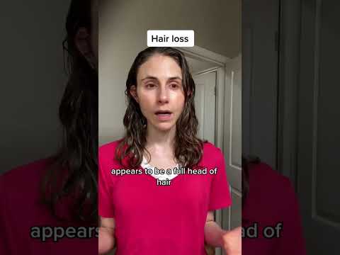 Understanding Congenital Hypotrichosis: Insights on Hair Loss