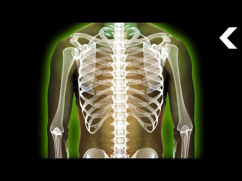 Understanding Acute Radiation Syndrome: Symptoms and Care Options post thumbnail image