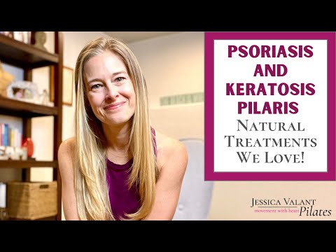 Understanding Psoriasis vs. Keratosis Pilaris: Key Differences