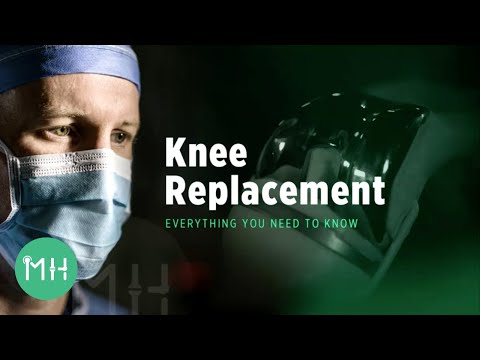 What You Should Know About Knee Replacement Surgery post thumbnail image