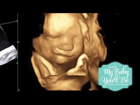 5-D Ultrasounds: Are They Worth It for Your Baby?