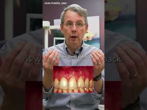Can Receding Gums Regrow? Examining Oil Pulling Benefits post thumbnail image