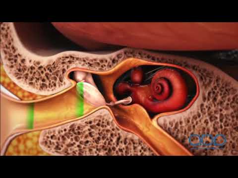Understanding Ear Anatomy: Diagrams for Health and Care
