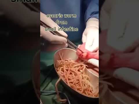 Worm Woes: Spotting Tapeworms vs. Pinworms in Your Life post thumbnail image