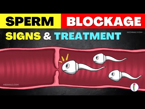 Understanding Low Sperm Count: Causes and Treatment Options