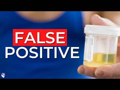 Understanding Causes of False Positive Drug Tests in Health