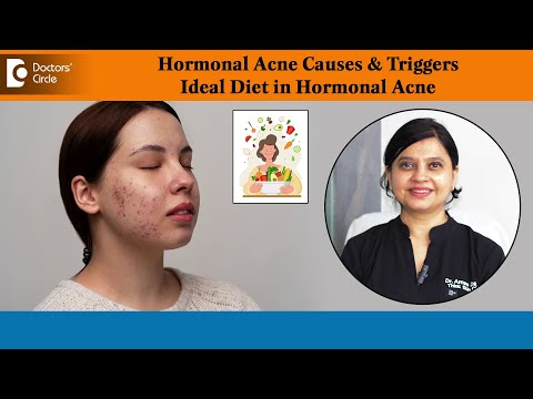 Foods to Help Manage Hormonal Acne: What to Eat post thumbnail image
