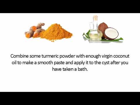 Effective Home Remedies for Bartholin Cysts