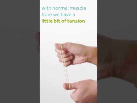 Understanding Hypotonia: Causes and Effects Explained