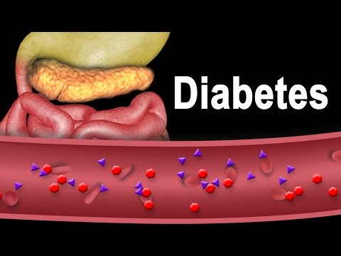 Understanding Diabetes: Key Insights and Information