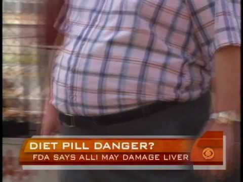 Understanding Alli Weight Loss Pills: What the Evidence Shows