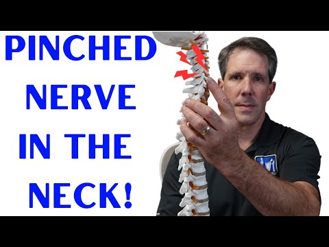 Understanding Pinched Nerves: Symptoms and Causes Explained post thumbnail image