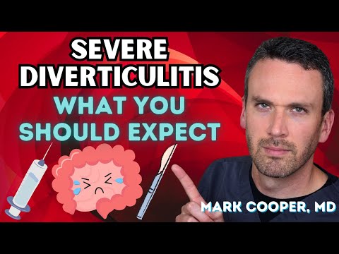 When Is it Time to Seek Hospital Care for Diverticulitis?
