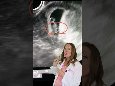 Seven Weeks Pregnant: Baby's Heartbeat and Growth Unveiled