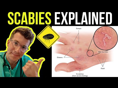 Spotting Common Skin Issues: Visual Rashes Explained