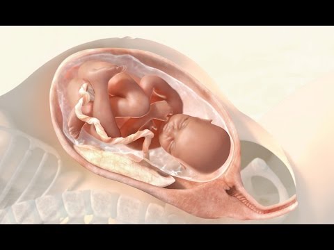 Understanding Placenta Delivery: What to Expect During Care