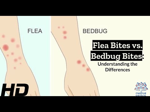 Identifying Bed Bug Bites: What You Need to Know for Health