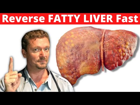 How to Reverse Non-Alcoholic Fatty Liver Disease Effectively