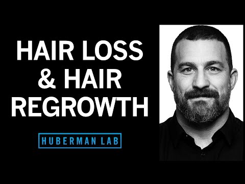 Effective Hair Loss Treatments for Men: What You Should Know