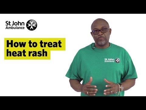 Soothe Your Skin: Natural Remedies for Heat Rash Relief