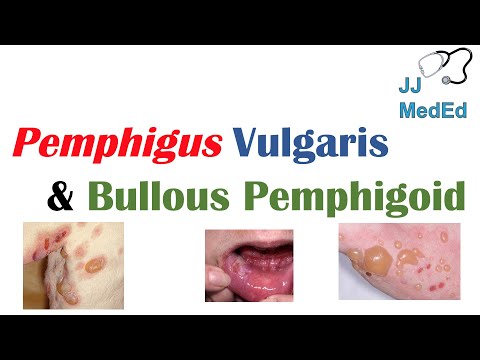 Pemphigus: Understanding Causes and Symptoms of this Condition