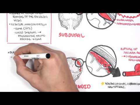 Understanding Hematomas: Types, Causes, and Treatment Options