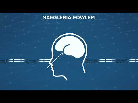 Understanding Brain Eating Amoeba: Risk and Prevention Tips