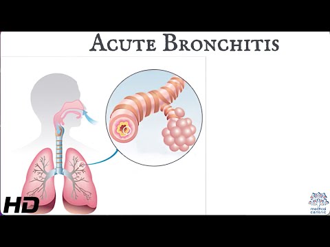 Recognizing Bronchitis Symptoms: Know What to Watch For