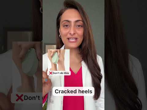 Effective Treatments for Cracked Heels and Dry Skin