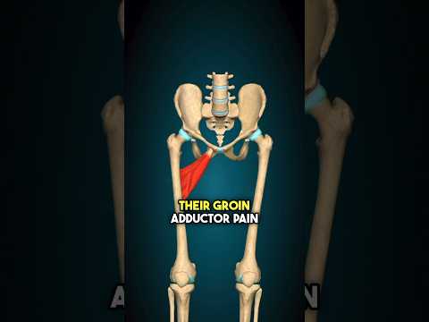 Understanding Adductor Tendinopathy: Causes and Solutions