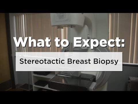 Understanding Stereotactic Breast Biopsy: What to Expect