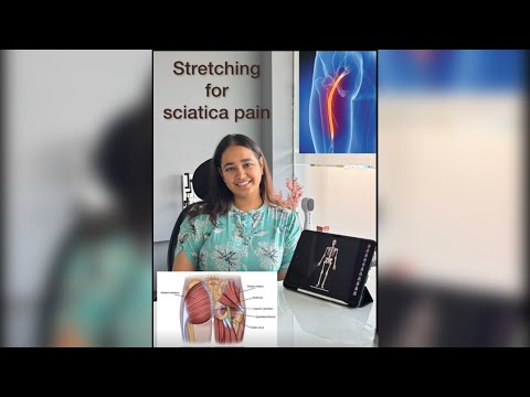 5 Effective Exercises for Relieving Low Back Pain and Sciatica