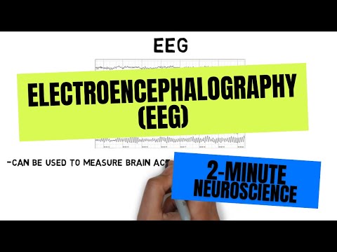 Understanding EEG Tests: What to Expect and How They Work