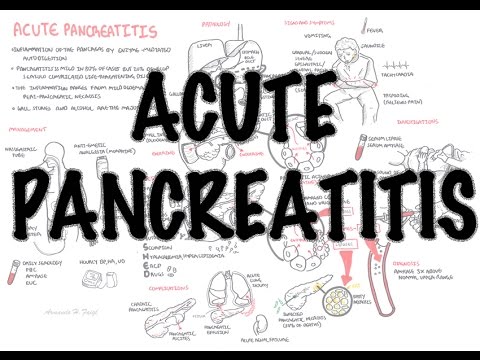 Understanding Pancreatitis: Symptoms and Treatments Explained