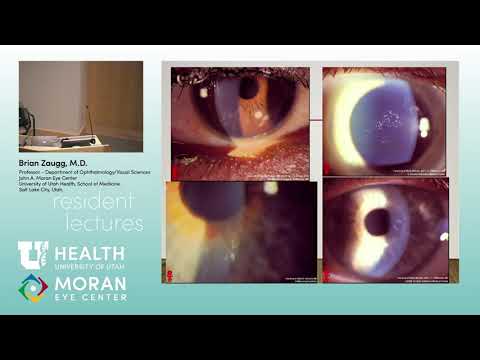 Understanding Corneal Dystrophies: Symptoms and Treatments