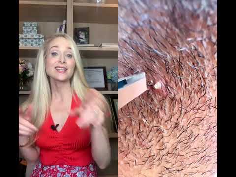Recognizing Ingrown Hair Symptoms on the Penis: What to Know