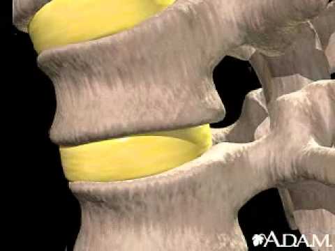 Understanding the Nucleus Pulposus: Key to Spine Health post thumbnail image