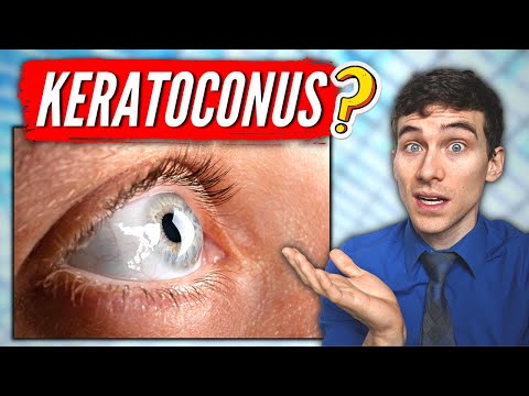 Keratoconus: Understanding Causes, Symptoms, and Care Options