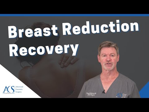 Breast Reduction Surgery: What to Expect and Costs Involved