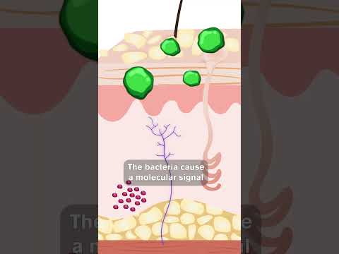 Understanding Pruritic Dermatitis: Causes and Treatments
