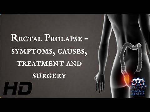 Understanding Rectal Discharge: Causes and Concerns post thumbnail image