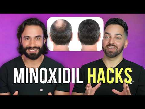 Can Minoxidil Help You Grow That Facial Hair? post thumbnail image