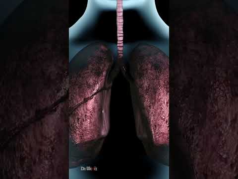 Essential Insights for Your Upcoming Nicotine Test