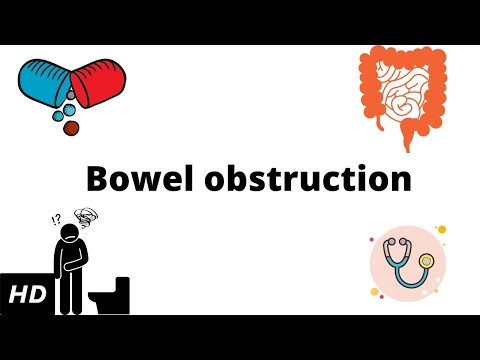 Understanding Bowel Obstruction: Causes and Solutions