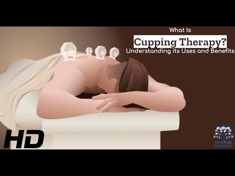 Cupping Therapy: A Deep Dive into Its Benefits and Uses post thumbnail image