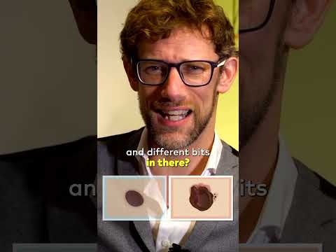 Is That New Mole on Your Skin Worth Noticing? post thumbnail image