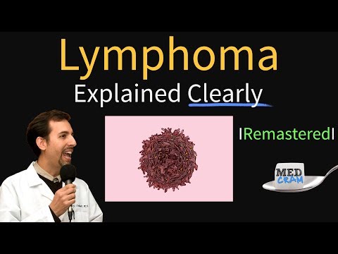 Understanding Non-Hodgkin Lymphoma: Causes and Risks Explained