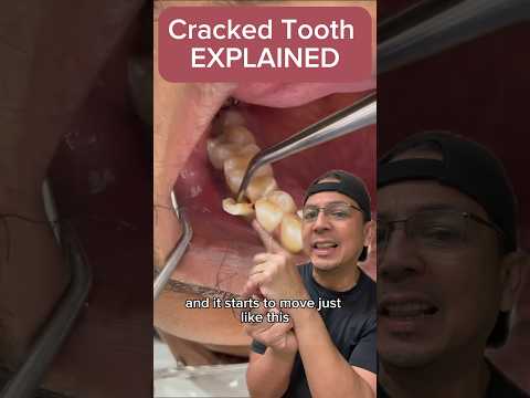 Effective Treatments for Repairing Chipped or Broken Teeth